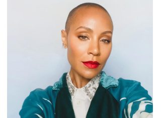 Alopecia Areata: A Disease that Jada Pinkett Smith Suffers From.