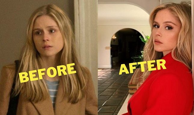 Erin Moriarty Plastic Surgery – Find out the Real Truth! Erin Moriarty Plastic Surgery