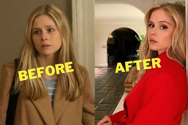 Erin Moriarty Plastic Surgery