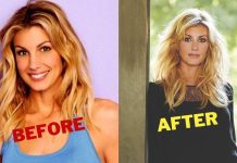 All You Need to Know About Faith Hill Plastic Surgery Faith Hill Plastic Surgery - Faith Hill Facelift