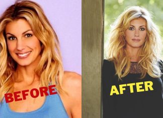 All You Need to Know About Faith Hill Plastic Surgery Faith Hill Plastic Surgery - Faith Hill Facelift