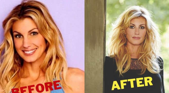 All You Need to Know About Faith Hill Plastic Surgery Faith Hill Plastic Surgery - Faith Hill Facelift