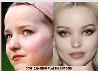 Dove Cameron Plastic Surgery: Exploring the Rumors and Facts Dove Cameron Plastic Surgery - Dove Cameron Shameless