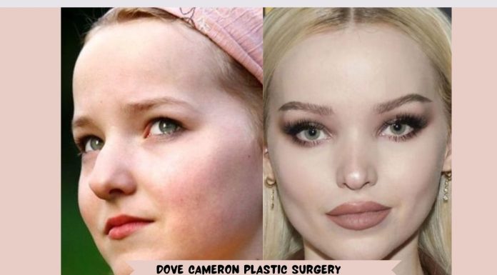 Dove Cameron Plastic Surgery: Exploring the Rumors and Facts Dove Cameron Plastic Surgery - Dove Cameron Shameless
