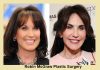 Robin McGraw Plastic Surgery: Everything You Need to Know Robin McGraw Plastic Surgery