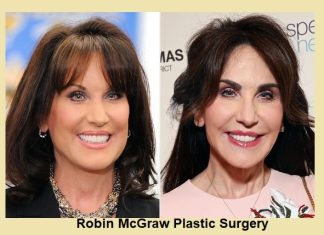 Robin McGraw Plastic Surgery: Everything You Need to Know Robin McGraw Plastic Surgery