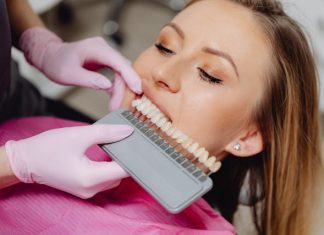 Top Ways to Reduce the Cost of Professional Teeth Whitening in the U.S.