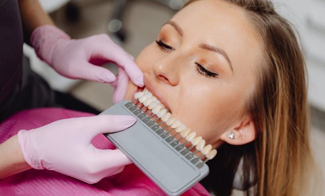 Top Ways to Reduce the Cost of Professional Teeth Whitening in the U.S.